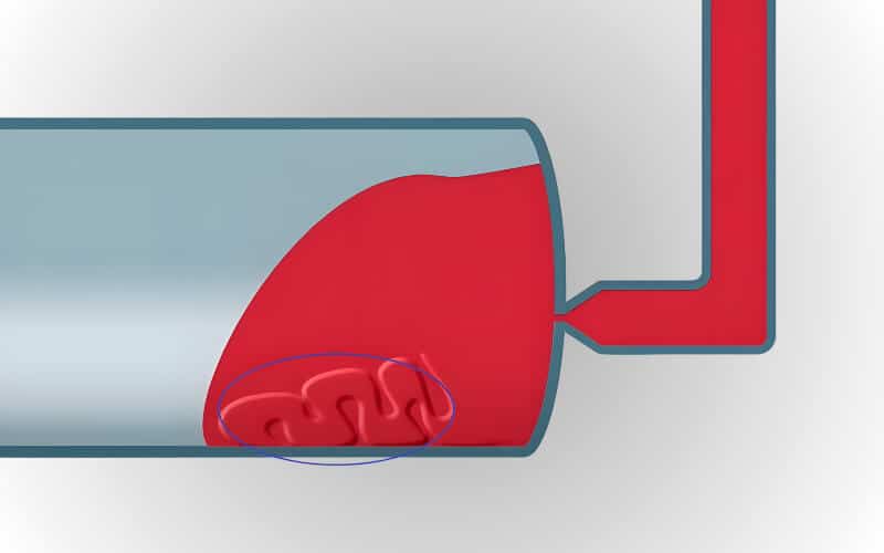 what-causes-flow-marks